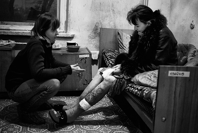 Woman with scarred legs sitting on couch while a caregiver kneels in front of her