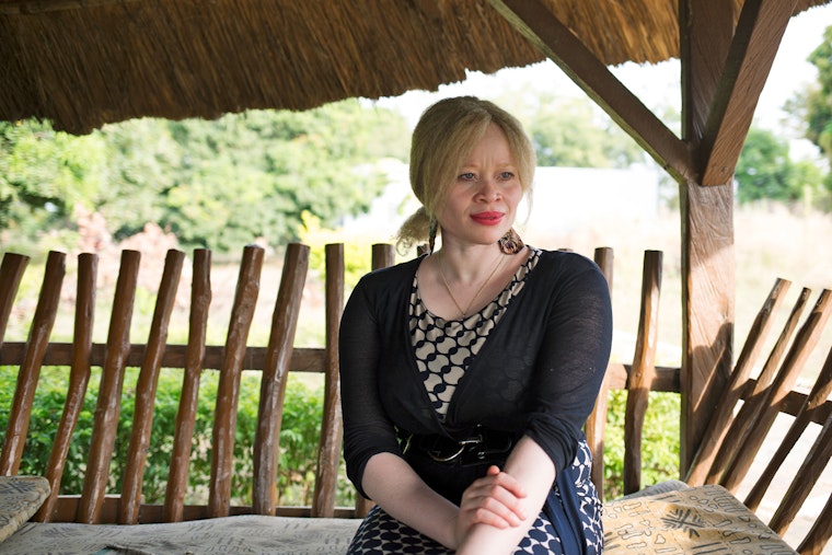 Ikponwosa Ero, UN independent expert on the enjoyment of human rights by persons with albinism, on the Niger River in Bamako, Mali. Photo credit: © Annie Risemberg for the Open Society Foundations Ikponwosa Ero sitting in a gazebo